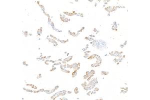 Immunocytochemistry (ICC) image for anti-HRas proto-oncogene, GTPase (HRAS) (AA 50-100) antibody (ABIN7795746)