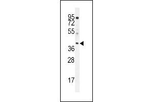 ELMOD2 Antikörper  (C-Term)