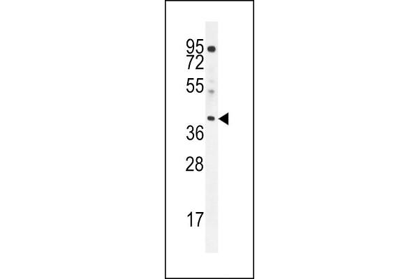 ELMOD2 Antikörper  (C-Term)