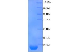 SDS-PAGE (SDS) image for Peptidase Inhibitor 3, Skin-Derived (PI3) (AA 61-117) protein (His tag) (ABIN5713726) (PI3 Protein (AA 61-117) (His tag))