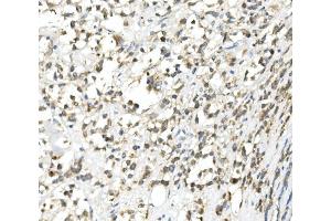 IHC analysis of DDIT3 using anti-DDIT3 antibody (ABIN7599026).