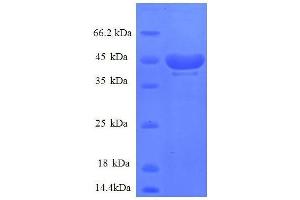 Ribosomal Protein S14 (RPS14) (AA 2-146), (partial) protein (GST tag) (RPS14 Protein (AA 2-146, partial) (GST tag))