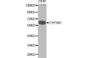 Western blot analysis of extracts of CEM cell lines, using CYP1B1 antibody. (CYP1B1 Antikörper)