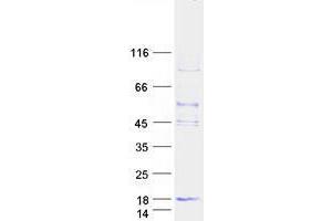 Western Blotting (WB) image for TYRO Protein tyrosine Kinase Binding Protein (TYROBP) (Transcript Variant 1) protein (Myc-DYKDDDDK Tag) (ABIN2734711)