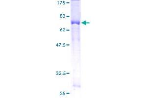 Image no. 1 for Thyroid Hormone Receptor Interactor 13 (TRIP13) (AA 1-432) protein (GST tag) (ABIN1323778) (TRIP13 Protein (AA 1-432) (GST tag))