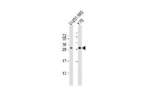 All lanes : Anti-PK1IP1L Antibody (Center) at 1:1000 dilution Lane 1: U-251 MG whole cell lysate Lane 2: Y79 whole cell lysate Lysates/proteins at 20 μg per lane. (MAPK1IP1L Antikörper  (AA 108-137))