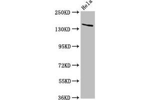 Western Blot Positive WB detected in: Hela whole cell lysate All lanes: LAMC2 antibody at 5 μg/mL Secondary Goat polyclonal to rabbit IgG at 1/50000 dilution Predicted band size: 131, 122 kDa Observed band size: 140 kDa (LAMC2 Antikörper  (AA 417-588))