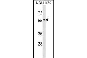 Western blot analysis in NCI-H460 cell line lysates (35ug/lane). (SIGLEC5 Antikörper  (N-Term))