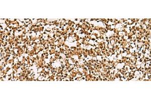 Immunohistochemistry of paraffin-embedded Human tonsil tissue using PHF5A Polyclonal Antibody at dilution of 1:55(x200) (PHF5A Antikörper)