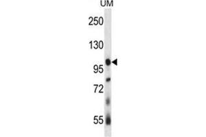 USP4 Antibody (N-term) western blot analysis in human uterine tumor tissue lysates (35 µg/lane). (USP4 Antikörper  (N-Term))