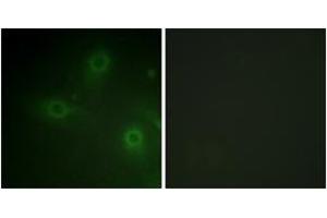 Immunofluorescence analysis of HeLa cells, using p47 phox (Ab-304) Antibody. (NCF1 Antikörper  (AA 281-330))