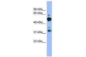 MPP2 antibody used at 1 ug/ml to detect target protein. (MPP2 Antikörper)
