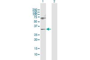 Western Blot analysis of SNF8 expression in transfected 293T cell line by SNF8 MaxPab polyclonal antibody. (SNF8 Antikörper  (AA 1-258))