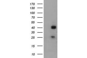 Western Blotting (WB) image for anti-alpha-1,4-N-Acetylglucosaminyltransferase (A4GNT) (AA 121-340) antibody (ABIN2715585) (A4GNT Antikörper  (AA 121-340))