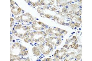 Immunohistochemistry of paraffin-embedded Human stomach using MAPKBP1 Polyclonal Antibody at dilution of 1:100 (40x lens). (MAPKBP1 Antikörper)