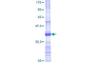 LDOC1 Protein (AA 19-120) (GST tag)