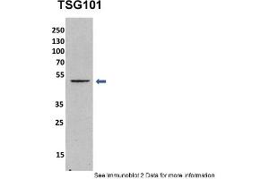 Sample Type: mouse fibroblast lusate (10ug)Primary Dilution: 1:1000 (1% BSA)Secondary Dilution: 1:2000 (5% milk)Image Submitted By: Anonymous researcher .
