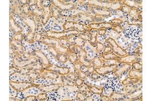 Phospho-WNK1 (Thr60) Antibody at 1/100 staining Mouse kidney tissue by IHC-P. (WNK1 Antikörper  (pThr60))