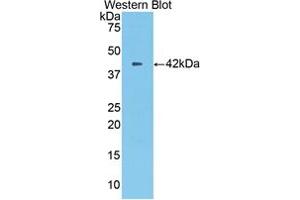 Western blot analysis of the recombinant protein. (CPB2 Antikörper  (AA 113-422))