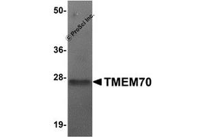 Western Blotting (WB) image for anti-Transmembrane Protein 70 (TMM70) (Middle Region) antibody (ABIN1031136) (Transmembrane Protein 70 (TMM70) (Middle Region) Antikörper)