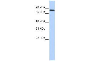 WB Suggested Anti-ADARB2 Antibody Titration:  0. (ADARB2 Antikörper  (Middle Region))