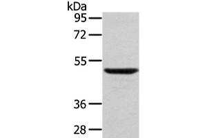 Western Blot analysis of Mouse lung tissue using WASF2 Polyclonal Antibody at dilution of 1/200 (WASF2 Antikörper)