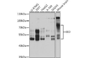 Western blot analysis of extracts of various cell lines, using EED antibody (ABIN6127866, ABIN6139942, ABIN6139945 and ABIN6221014) at 1:1000 dilution. (EED Antikörper  (AA 1-300))