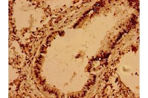 Immunohistochemistry of paraffin-embedded human lung tissue using ABIN7175485 at dilution of 1:100 (VAMP7 Antikörper  (AA 2-186))