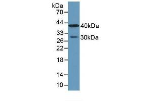 Detection of CPA4 in Human Lung Tissue using Polyclonal Antibody to Carboxypeptidase A4 (CPA4) (CPA4 Antikörper  (AA 55-421))