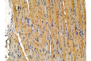 ABIN7095294 and ABIN7099351 at 1/100 staining rat muscle tissue by IHC-P. (CRYbA4 Antikörper)