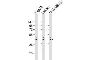 Western Blotting (WB) image for anti-UDP Glucuronosyltransferase 2 Family, Polypeptide B4 (UGT2B4) (AA 338-370) antibody (ABIN6242687)