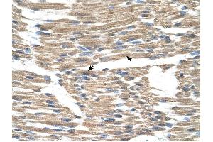 GPR177 antibody was used for immunohistochemistry at a concentration of 4-8 ug/ml to stain Skeletal muscle cells (arrows) in Human Muscle. (GPR177/WLS Antikörper  (N-Term))