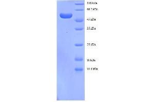tyrosine 3-Monooxygenase/tryptophan 5-Monooxygenase Activation Protein, beta Polypeptide (YWHAB) (AA 1-246), (full length) protein (GST tag)