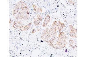 IHC analysis of PDCD6IP using anti-PDCD6IP antibody (ABIN7600490). (ALIX Antikörper  (AA 2-330))