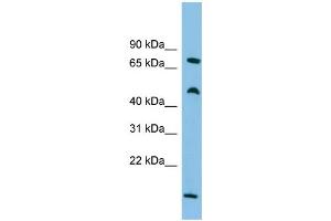 WB Suggested Anti-ECD Antibody Titration: 0. (ECD/SGT1 Antikörper  (Middle Region))