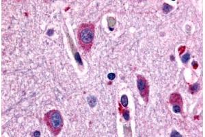 Anti-CHRM2 antibody  ABIN1048438 IHC staining of human brain, neurons and glia.