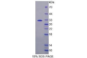SDS-PAGE analysis of Rat PLCb2 Protein.