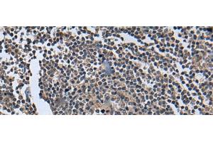 Immunohistochemistry (Paraffin-embedded Sections) (IHC (p)) image for anti-Wingless-Type MMTV Integration Site Family, Member 9B (WNT9B) antibody (ABIN7248257)