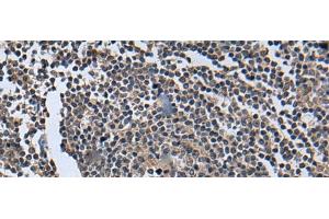 Immunohistochemistry of paraffin-embedded Human tonsil tissue using WNT9B Polyclonal Antibody at dilution of 1:85(x200) (WNT9B Antikörper)