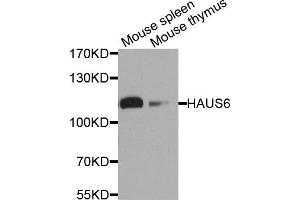 Western blot analysis of extracts of various cell lines, using HAUS6 antibody. (FAM29A Antikörper)