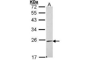 WB Image Sample (30 ug of whole cell lysate) A: A431 , 12% SDS PAGE antibody diluted at 1:1000 (Endomucin Antikörper)