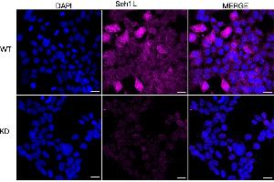 Immunocytochemical staining of HeLa cells using Seh1L antibody (ABIN7800290), 1:1,000), Top panel: wild-type (WT), Bottom panal: Seh1L shRNA knockdown (KD).