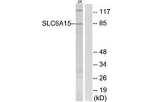 Western blot analysis of extracts from Jurkat cells, using SLC6A15 Antibody. (SLC6A15 Antikörper  (AA 32-81))