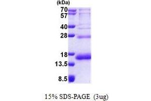 SDS-PAGE (SDS) image for Ribosomal Protein S19 (RPS19) (AA 1-145) protein (His tag) (ABIN6387234)