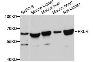 Western blot analysis of extracts of various cell lines, using PKLR antibody (ABIN5998530) at 1:3000 dilution. (PKLR Antikörper)