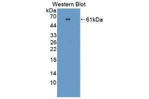 Detection of Recombinant PRCP, Mouse using Polyclonal Antibody to Prolylcarboxypeptidase (PRCP) (PRCP Antikörper  (AA 169-443))