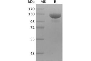 Western Blotting (WB) image for Receptor Tyrosine-Protein Kinase ErbB-3 (ERBB3) protein (mFc Tag) (ABIN7319862) (ERBB3 Protein (mFc Tag))