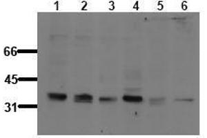 Western Blotting (WB) image for anti-B-Cell CLL/lymphoma 10 (BCL10) (pSer138) antibody (ABIN126733) (BCL10 Antikörper  (pSer138))