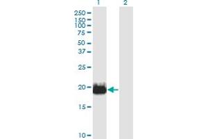 Western Blot analysis of IFT20 expression in transfected 293T cell line by IFT20 monoclonal antibody (M02), clone 3F3. (IFT20 Antikörper  (AA 1-148))