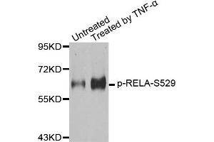 Western Blotting (WB) image for anti-Nuclear Factor-kB p65 (NFkBP65) (pSer529) antibody (ABIN1870581) (NF-kB p65 Antikörper  (pSer529))